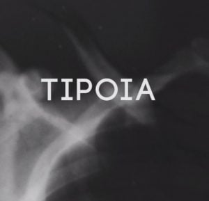 Tipóia